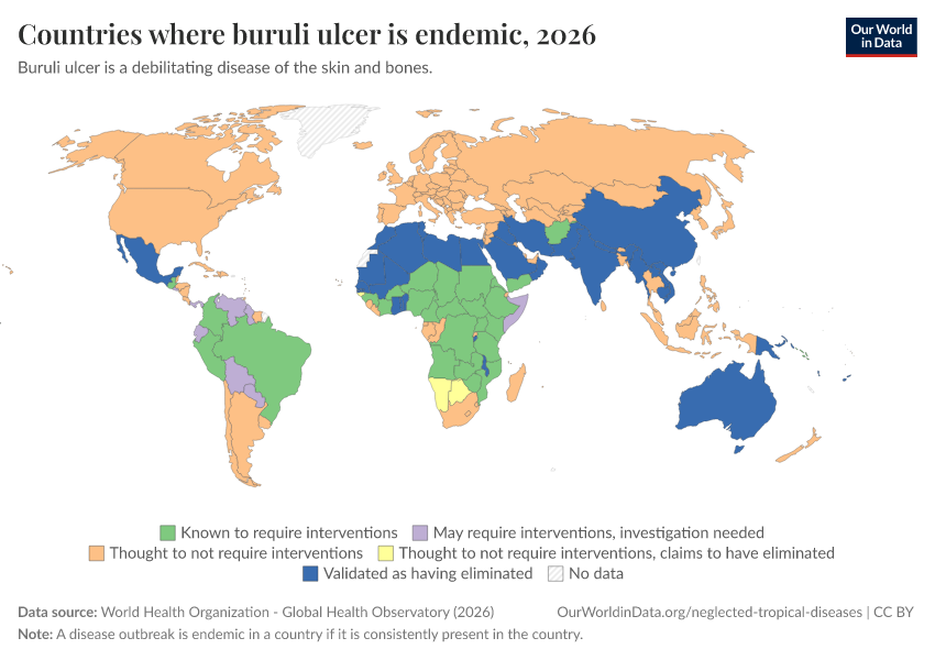 A thumbnail of the "Countries where buruli ulcer is endemic" chart